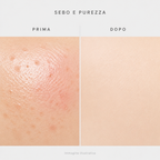 Sebo e purezza prima e dopo - immagine illustrativa