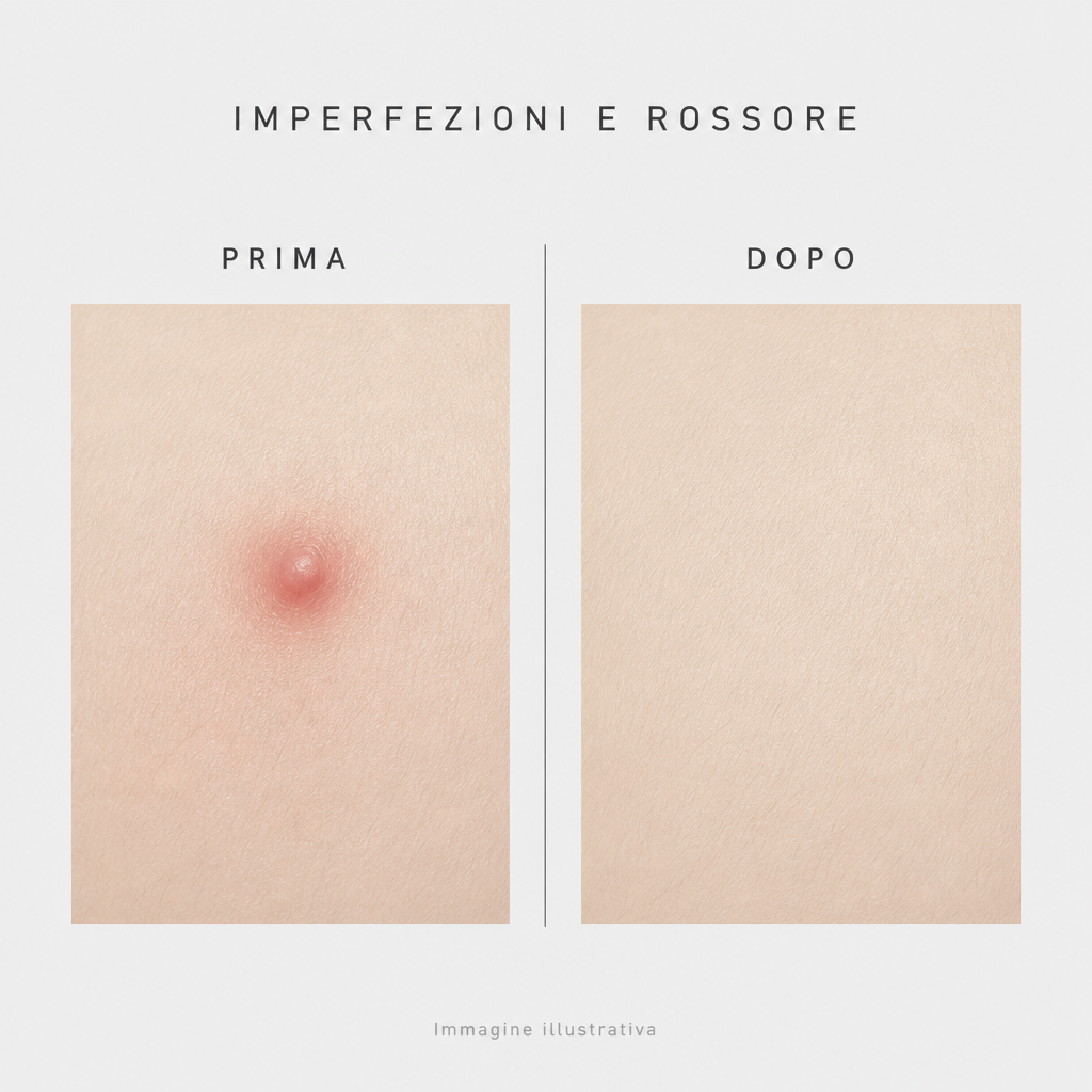 Imperfezioni e rossore prima e dopo - immagine illustrativa